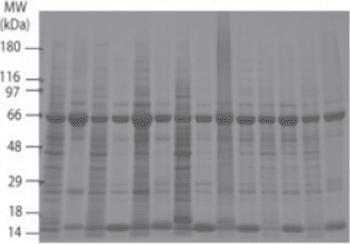 Imagen: La membrana de tejido de mama OncoPair INSTA-Blot (Fotografía cortesía de Imgenex).